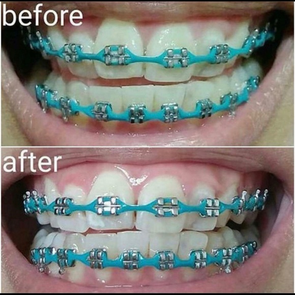 New-Three (3)Nuskin Ap24 Whitening Fluoride Toothpaste - Picture 6 of 17